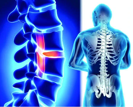 World conference on osteoporosis opens