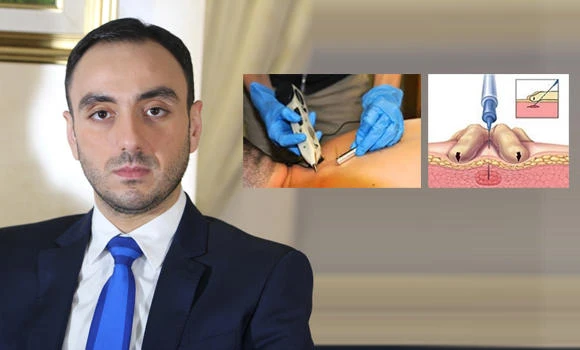 Treatment lies within the needle itself