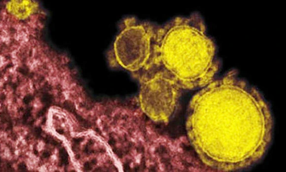 Elderly man in Taif infected with MERS