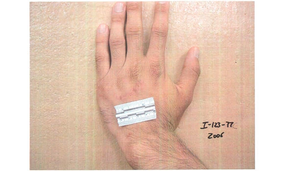 Pentagon releases photos of abused detainees