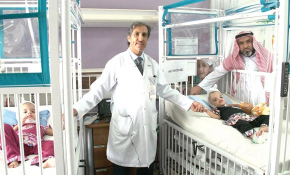 Separated twins 'talk and move on their own now'