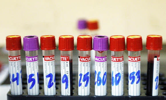 Local Zika outbreaks in US likely, says expert