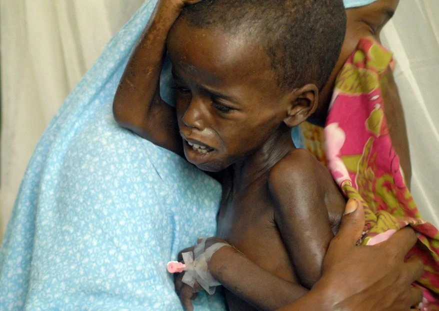 A severely malnourished child waits with his mother to be admitted to Banadir Hospital in Somalia’s capital Mogadishu. An estimated 3.7 million people in Somalia — around a third of the population — are on the brink of starvation and millions more in Djibouti, Ethiopia, Kenya and Uganda have been struck by the worst drought in the region in 60 years. (AFP)