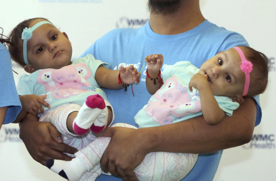 Abel Camacho holds his daughters Bellanie, left, and Ballanie, at Maria Fareri Children's Hospital in Valhalla, New York. (Seth Harrison/The Journal News via AP)