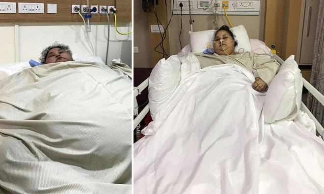500kg Egyptian sheds half her weight after India surgery