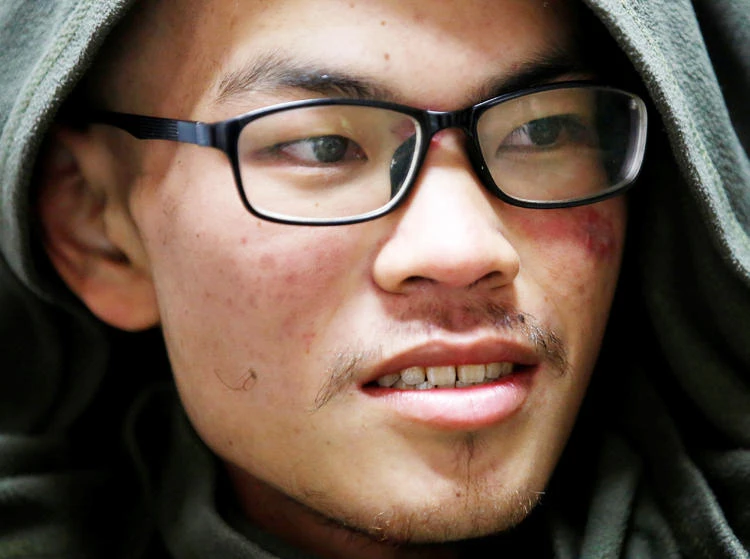 Taiwanese Liang Sheng Yueh smiles as he undergoes treatment at a hospital after being rescued, Kathmandu, Nepal on Wednesday. (Reuters)