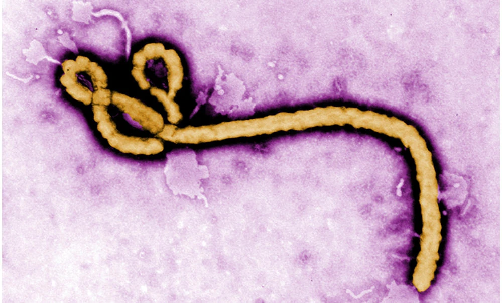 The World Health Organization confirms second Ebola case in Congo. (AP)