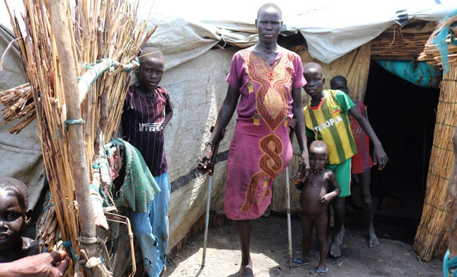 Mary Nyakwas, a disabled woman, stands with her children outside her hut in Bentiu, South Sudan. (AP)