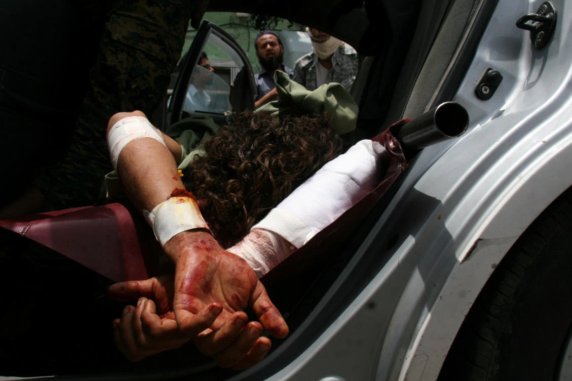 A pro-government fighter lies in a car after he was injured in clashes with Houthis, who said on Tuesday that they will boycott the UN peace envoy to Yemen. (Reuters)