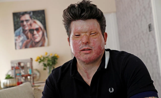 Saudi Embassy issues warning over London acid attacks
