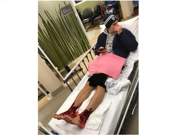 This handout picture taken and released by Jarrod Kanizay, father of Australian teenager Sam Kanizay, on August 7, 2017 shows Sam Kanizay with his injured feet waiting for medical aide at hospital in Melbourne. The Australian teenager emerged from a night-time dip in the ocean with blood streaming from his feet and ankles in a gruesome mystery that doctors have struggled to explain. (AFP)