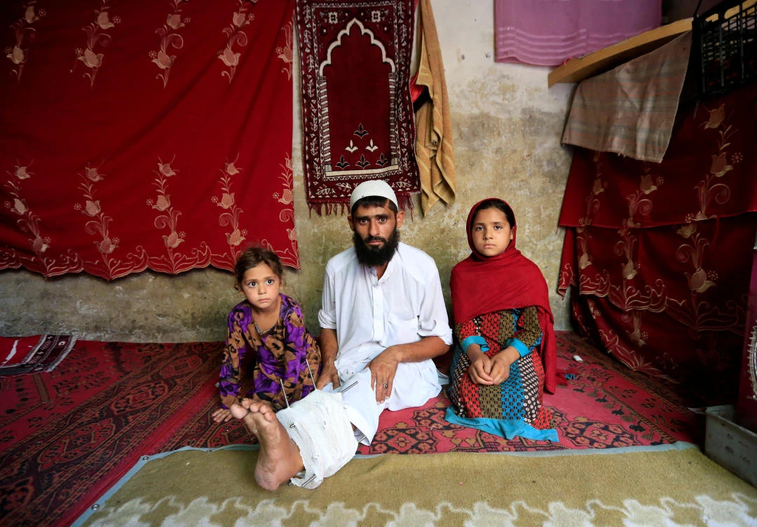 Mehrullah Safi, 28, a disabled Afghan National Army (ANA) soldier, sits with his children at their house in Jalalabad province, Afghanistan. August 2, 2017. Picture taken on August 2, 2017. (REUTERS)