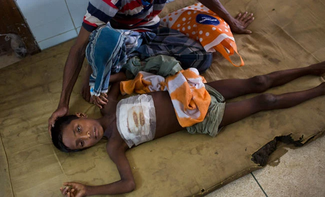 Shoabib, seven-year old Rohingya boy lies on the floor next to his father at Sadar Hospital in Cox's Bazar, Bangladesh on Sept. 10, 2017. Shoabib got a bullet injury on the chest when Myanmar soldiers attacked his village. He and his father lost track of their family members when fleeing to Bangladesh. (AP)