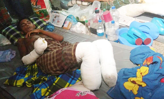 MOHAMMAD HOSSAIN: LOST ONE LEG