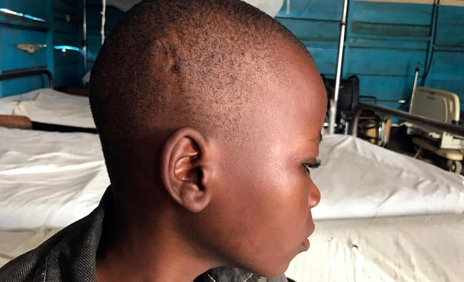 Children flee, fight amid Congo’s growing Kasai violence
