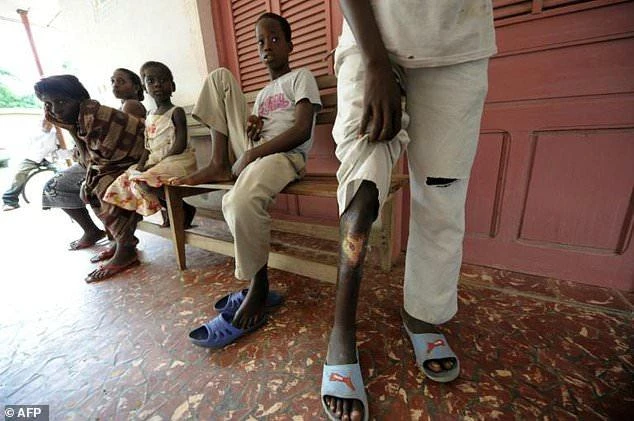 World Health Organisation data showed 2,037 new cases of buruli ulcer reported from 13 nations in 2015, with the majority in West and Central Africa, including Benin, Cameroon and Ghana. (AFP)