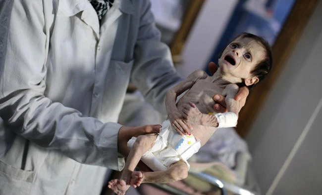 Syrian children die of hunger under regime siege