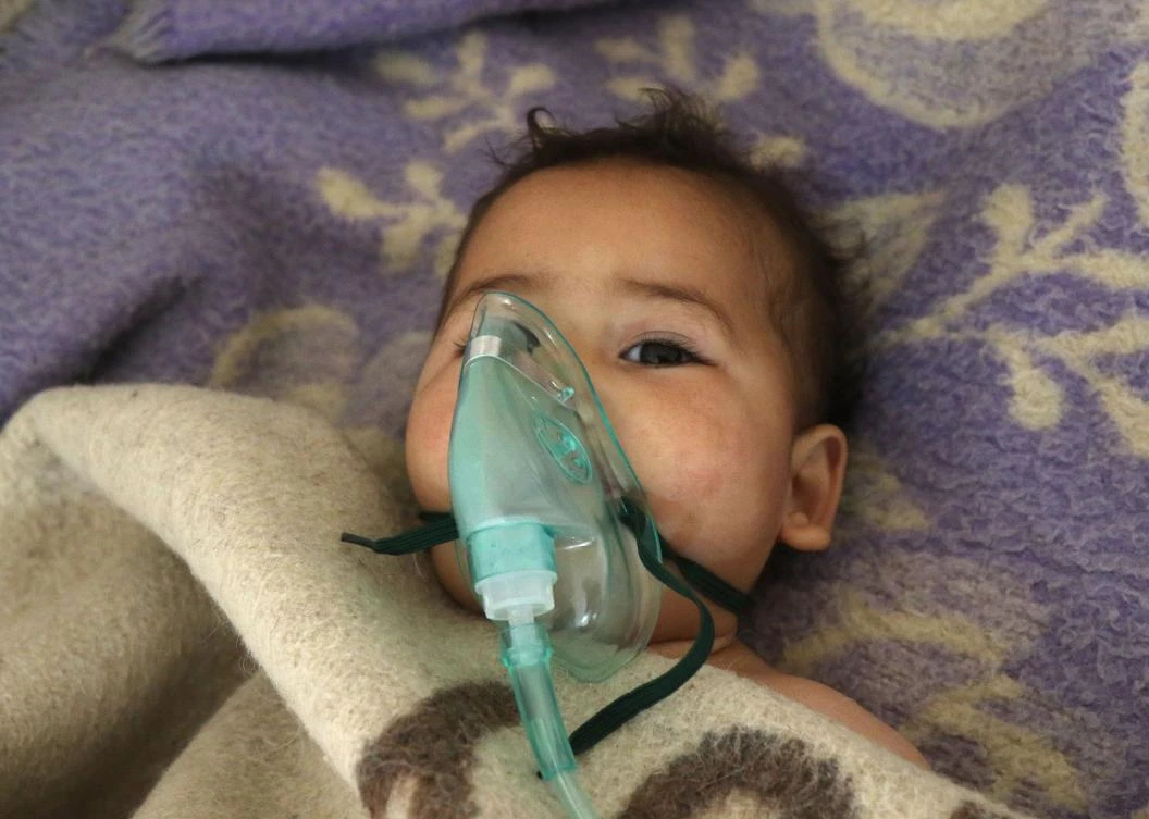 A Syrian child receiving treatment at a small hospital in the town of Maaret Al-Noman following a suspected toxic gas attack in Khan Sheikhun, a nearby rebel-held town in Syria’s northwestern Idlib province, on April 4, 2017. (AFP)