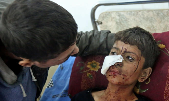 An injured Syrian child lies on a bed at a makeshift hospital following a reported government shelling in the rebel-held besieged town of Jisreen, east of the capital Damascus, on October 31, 2017. (AFP)