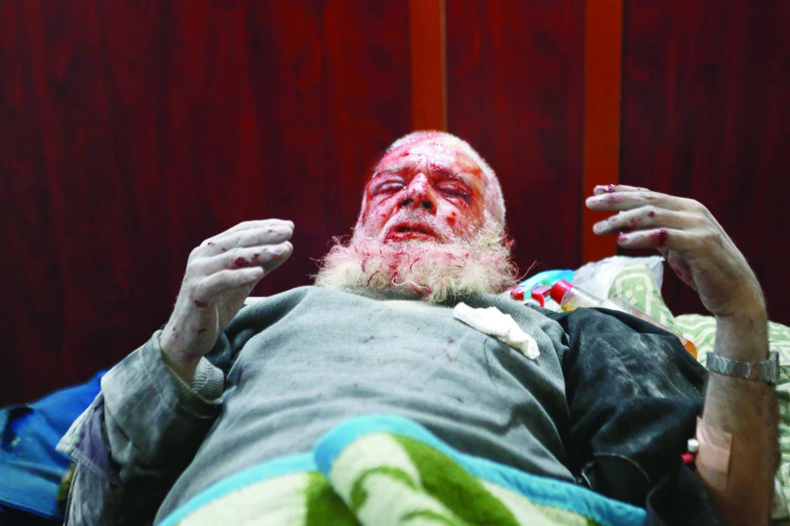 A Syrian man waits for treatment at a hospital in the Eastern Ghouta region on the
outskirts of Damascus. (AFP)