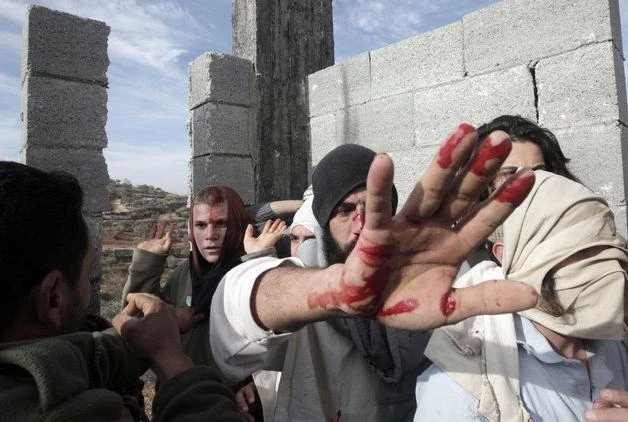 File photo of bloodied Jewish settlers in Qusra in Palestine, after a confrontation with Palestinians. (AFP)