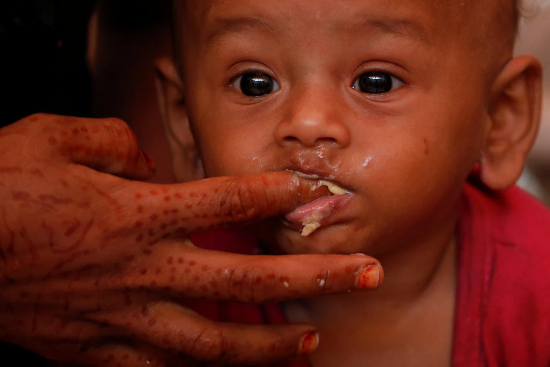Rohingya refugees in Bangladesh now face malnutrition on an “alarming” scale, say aid agencies. Above, a child is fed at a UNICEF medical center at Balukhali refugee camp near Cox’s Bazar, Bangladesh. (Reuters)