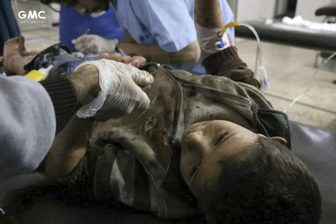 This file photo shows an injured boy receiving treatment at a hospital in Ghouta, an opposition-controlled suburb of Damascus, Syria. (AP)