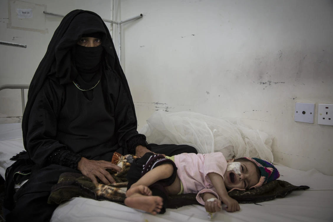 April 2017 — Yemen. “Besam’s child is severely malnourished. She has fever, diarrhea and even if she can recover with the required treatment, malnutrition can affect her growth on the long-term. Pictures of malnourished children are often used to depict the terrible conditions, but often, the look in their parents’ eyes is even more striking, like a mixture of helplessness and despair,” Florian Seriex
