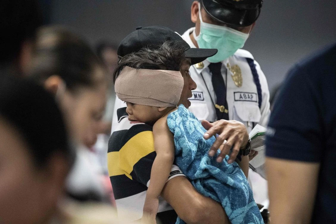 A child injured by firecracker is seen at the Jose Reyes Memorial Medical Center in Manila early on January 1, 2018, after new year's celebrations. (AFP)
