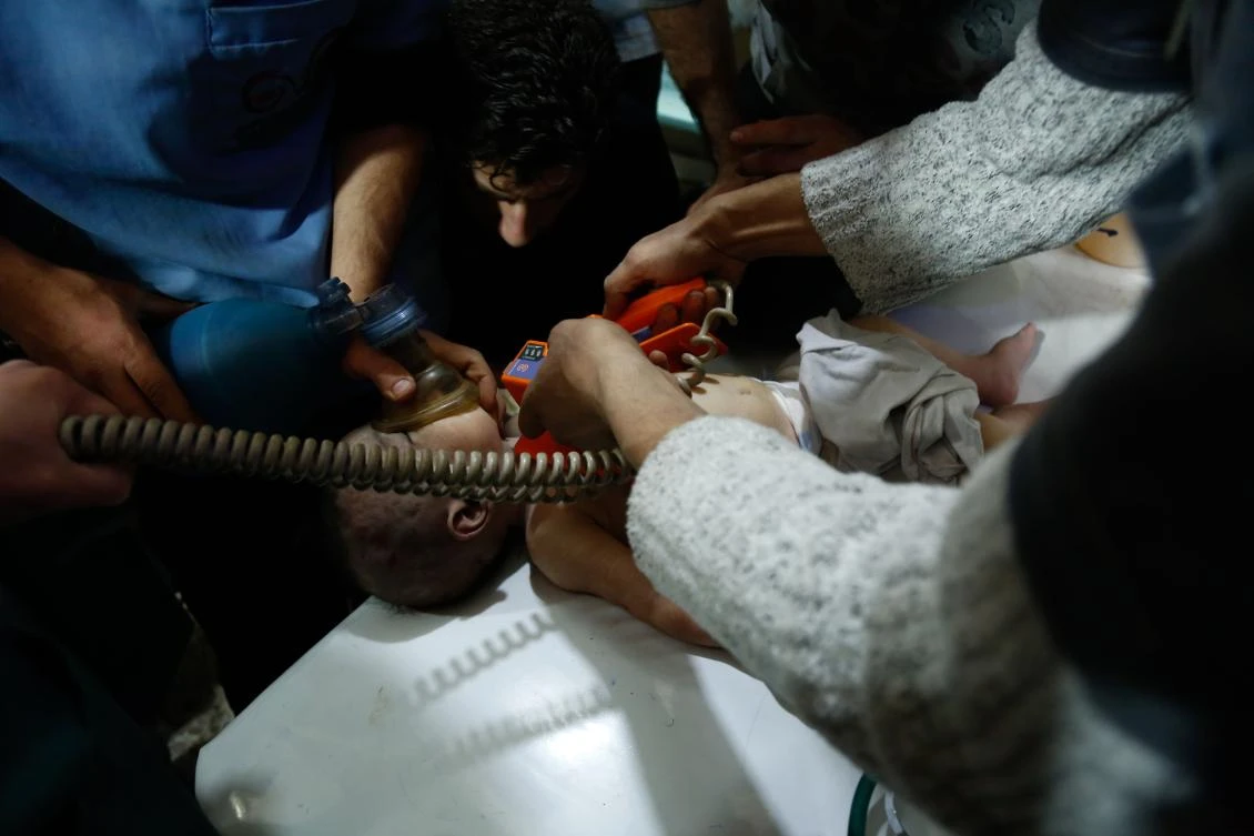 A Syrian child who was injured in shelling on the town of Misraba receives treatment at a make-shift hospital in the besieged rebel-held town of Douma, on the outskirts of the capital Damascus on early Jan. 4, 2018. At least 23 civilians were killed in the Syrian opposition redoubt of East Ghouta, near Damascus, with the majority of victims perishing in Russian air raids, a monitor said. (AFP/Hasan Mohamed)