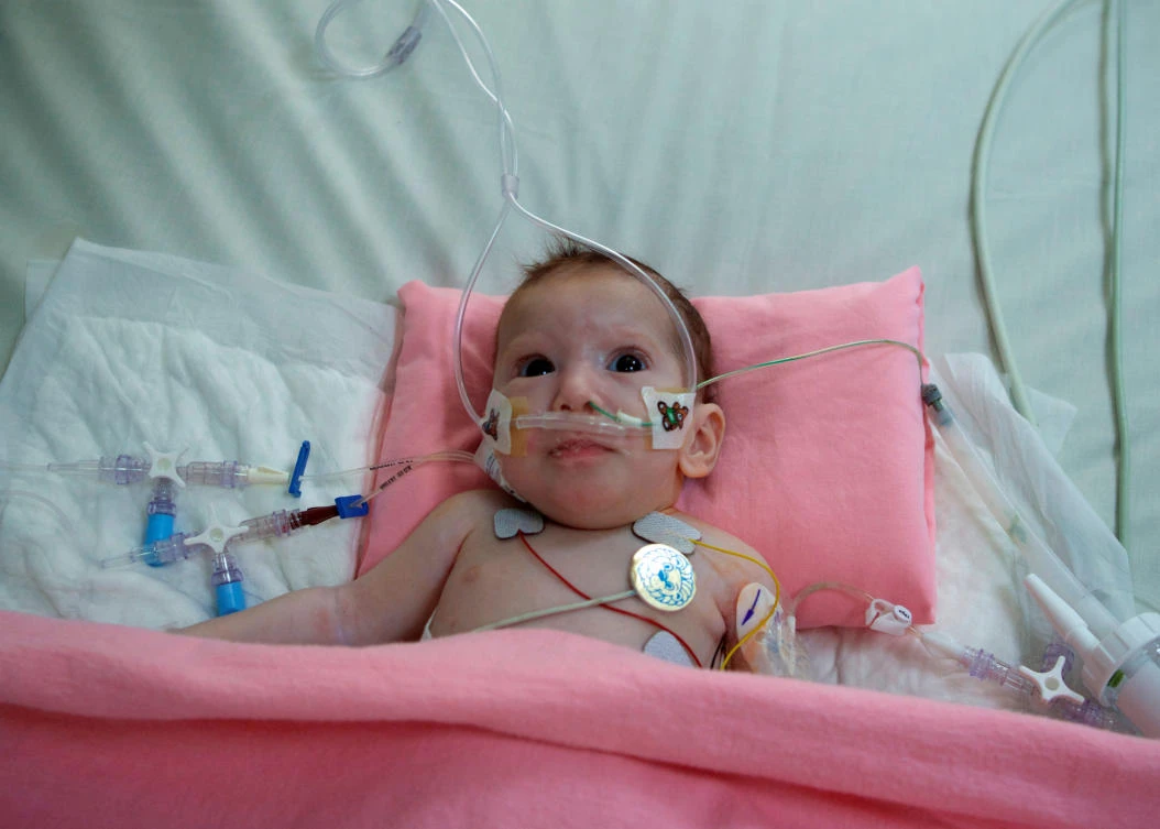Palestinian baby Haneen ‘stable’ after separation surgery in Saudi Arabia