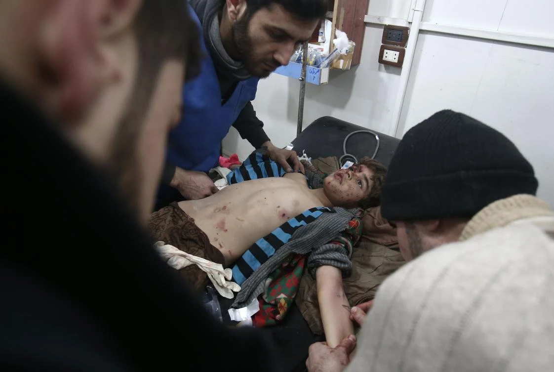 A Syrian child is treated at a makeshift hospital in the rebel-held besieged town of Arbin, in the eastern Ghouta region on the outskirts of the capital Damascus on February 5, 2018, following airstrikes. (AFP)