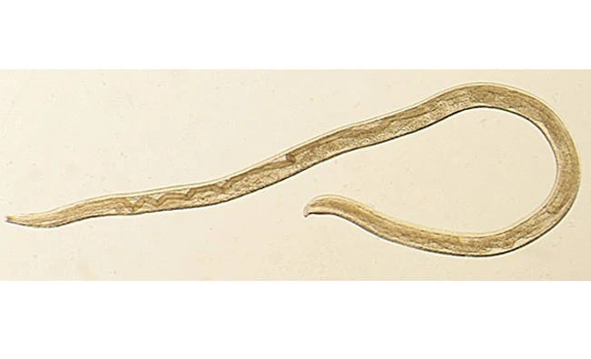Thelazia gulosa, a type of eye worm appears in a handout photo provided by the U.S. Centers for Disease Control (CDC), on February 8, 2018. (Reuters)