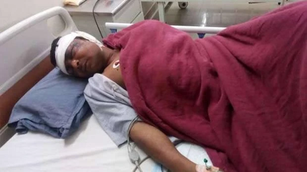 The man had acid injected into his eyes after eloping with his boss's wife. (Social media)