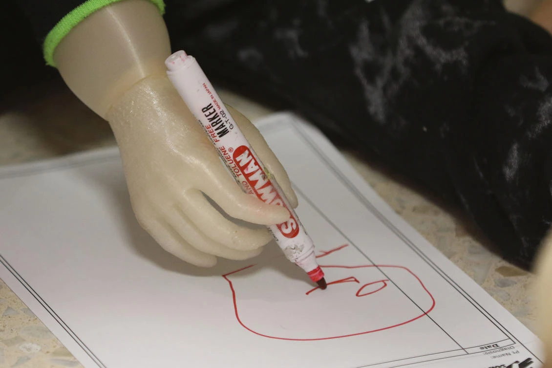 A picture taken on January 16, 2018, shows three-year-old child Ruwayd using her new prosthetic arm to draw shapes on a piece of paper at the Doctors Without Borders reconstructive surgery hospital in the Jordanian capital Amman. (AFP)
