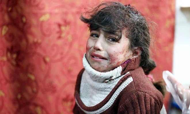 Hala, 9, receives treatment at a makeshift hospital following Syrian government bombardments on rebel-held town of Saqba, in the besieged Eastern Ghouta region on the outskirts of the capital Damascus on Thursday. (AFP)