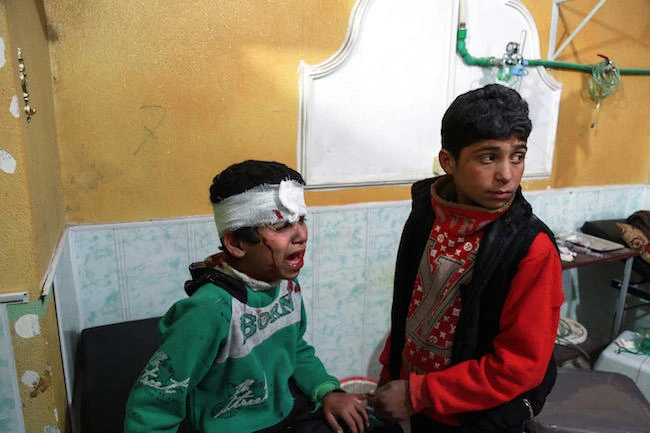 A bandaged Syrian child cries as he sits in a clinic in the rebel-held town of Douma, in the besieged Eastern Ghouta region on the outskirts of the capital Damascus, following reported regime bombardment on the area on February 24, 2018. (AFP)