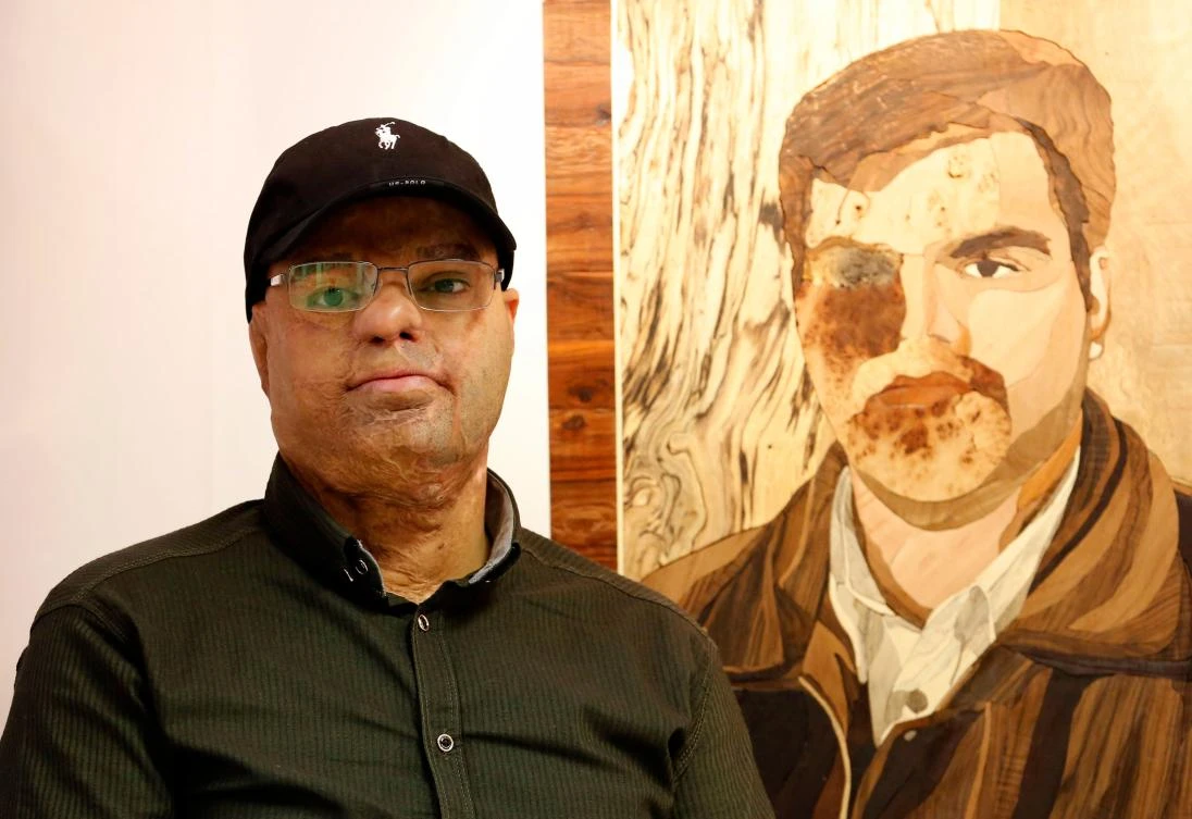 Mohsen Mortazavi, an Iranian victim of acid attack, presents his work at the Ashianeh gallery in Tehran on February 28, 2018. (AFP)