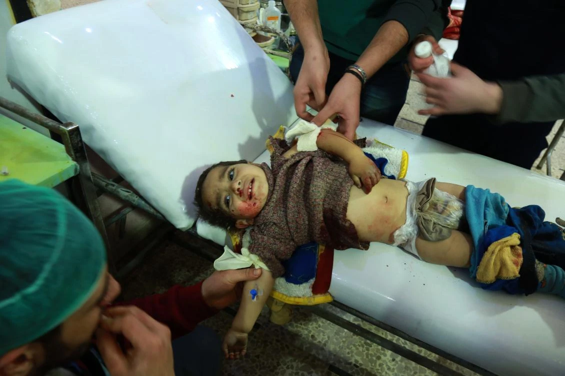 A wounded Syrian child receives treatment at a make-shift hospital in Douma following Syrian government bombardments on the besieged rebel-held enclave of Eastern Ghouta on March 4, 2018. (AFP)
