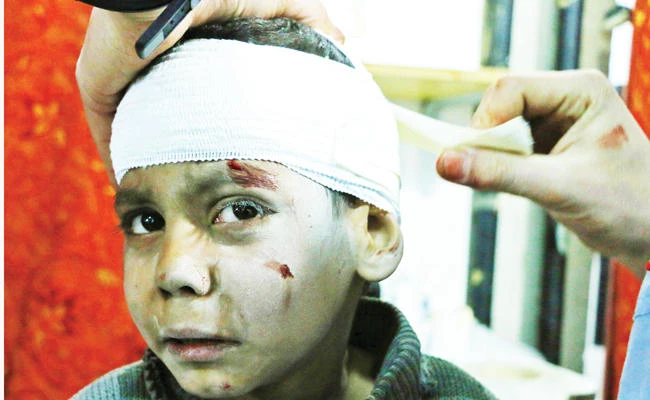 Syrian child Hossam Hawari, 8, is treated from a shrapnel wound at a makeshift clinic in Kafr Batna following Syrian regime airstrikes on opposition-held areas in the Eastern Ghouta region on the outskirts of the capital Damascus on Tuesday. (AFP)