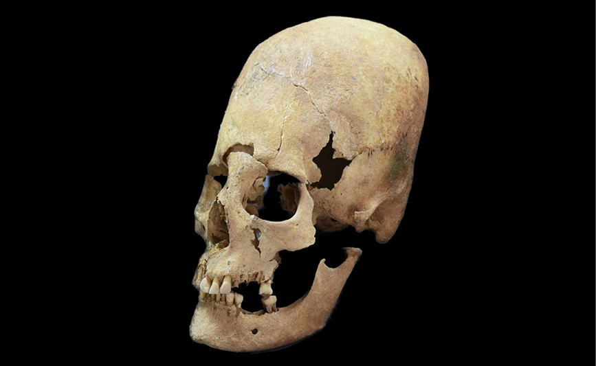 Photo provided by the State collection for Anthropology and Palaeoanatomy Munich shows an artificially deformed female skull from Altenerding, an Earyl Medieavel site in Bavaria, Germany. (State collection for Anthropology and Palaeoanatomy Munich via AP)