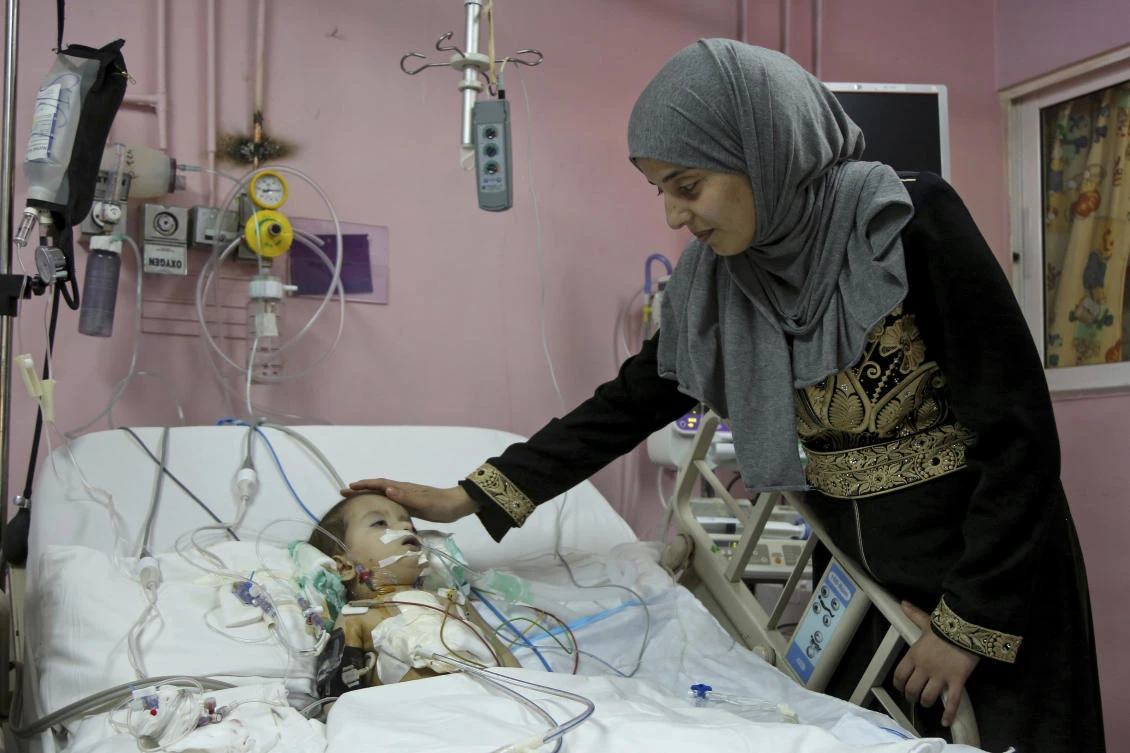 Syrian refugee Sara Al-Matoura caresses her one-year-old daughter Eman Zatima after her surgery at a hospital in Amman, Jordan/. (AP)