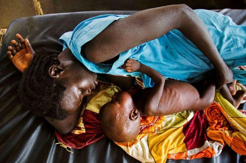 A mother breastfeeds her child suffering from acute malnutrition at a clinic run by Doctors Without Borders (MSF) in Aweil, northern Bahr al-Ghazal, South Sudan (AFP)