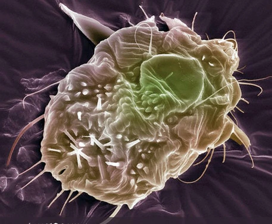 Thousands of scabies cases were recently reported and cured in Saudi Arabia, according to the the Saudi Ministry of Health. (Al-Ekhbariya)