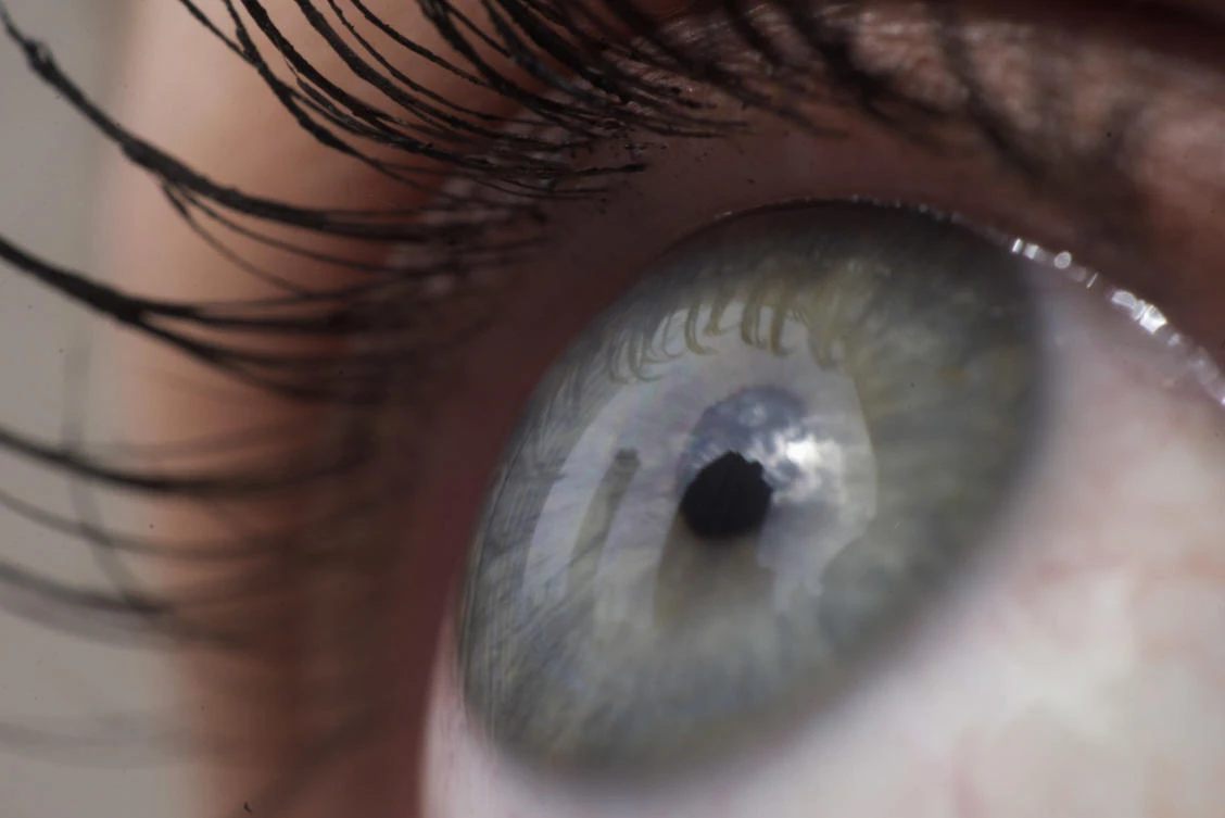 Fish oil supplements don’t help dry eye disease
