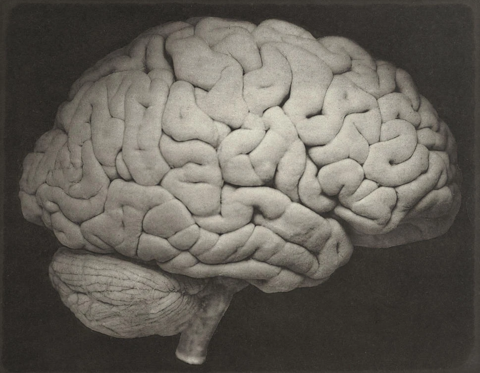 How human brains became so big