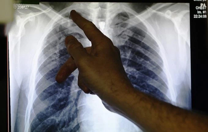 Scientists map genetic codes of 3,000 dangerous bacteria