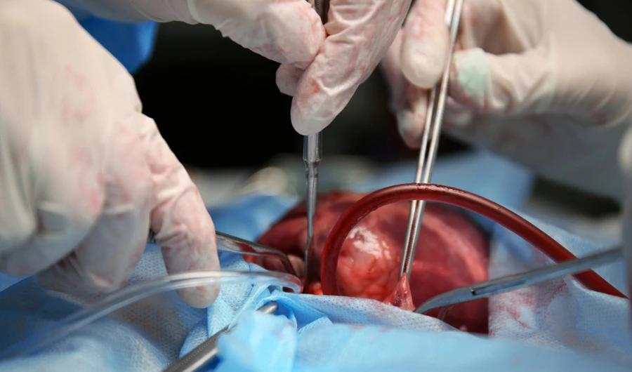 Egyptian court finds  37 guilty at illegal  organ trading trial