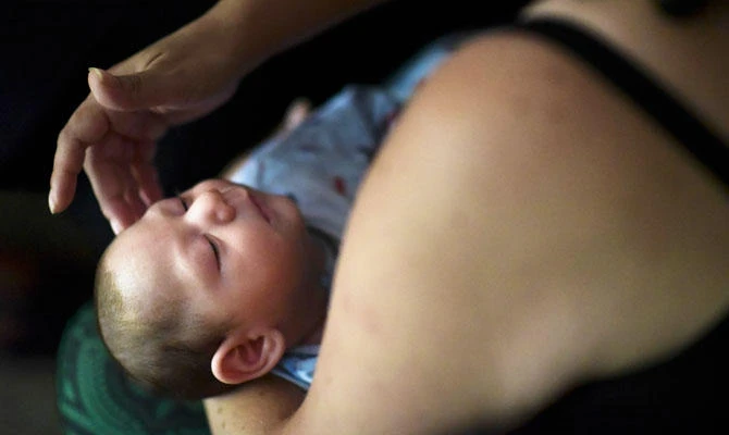 In this Dec. 16, 2016 file photo, Puerto Rico resident Michelle Flandez caresses her two-month-old son Inti Perez, diagnosed with microcephaly linked to the mosquito-borne Zika virus, in Bayamon, Puerto Rico. (AP)