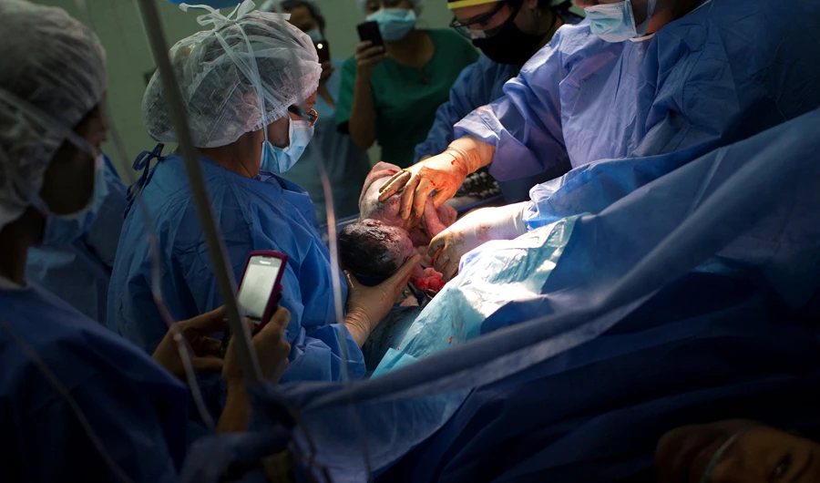 Doctors warn of global C-section ‘epidemic’